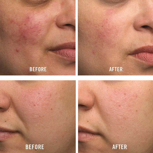 Ultra Repair Cream Travel Size 56g