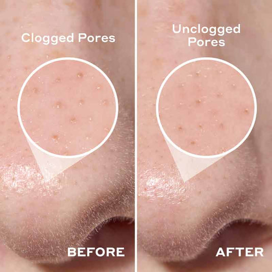 2-in-1 Deep Cleansing Pore Strip by Mario Badescu