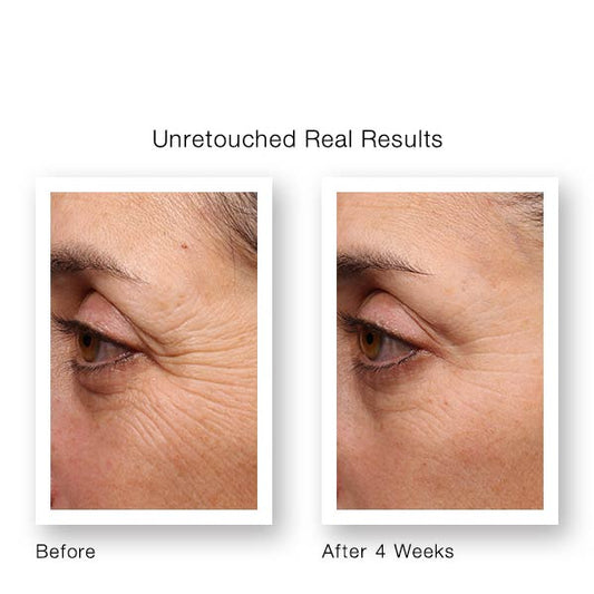 Resurgence Retinol Youth Renewal Eye Serum 15ml