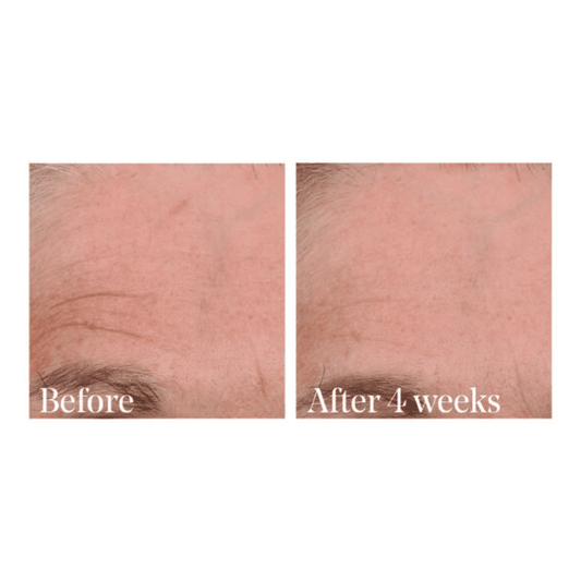 Retinal ReSculpt Overnight Treatment by Murad