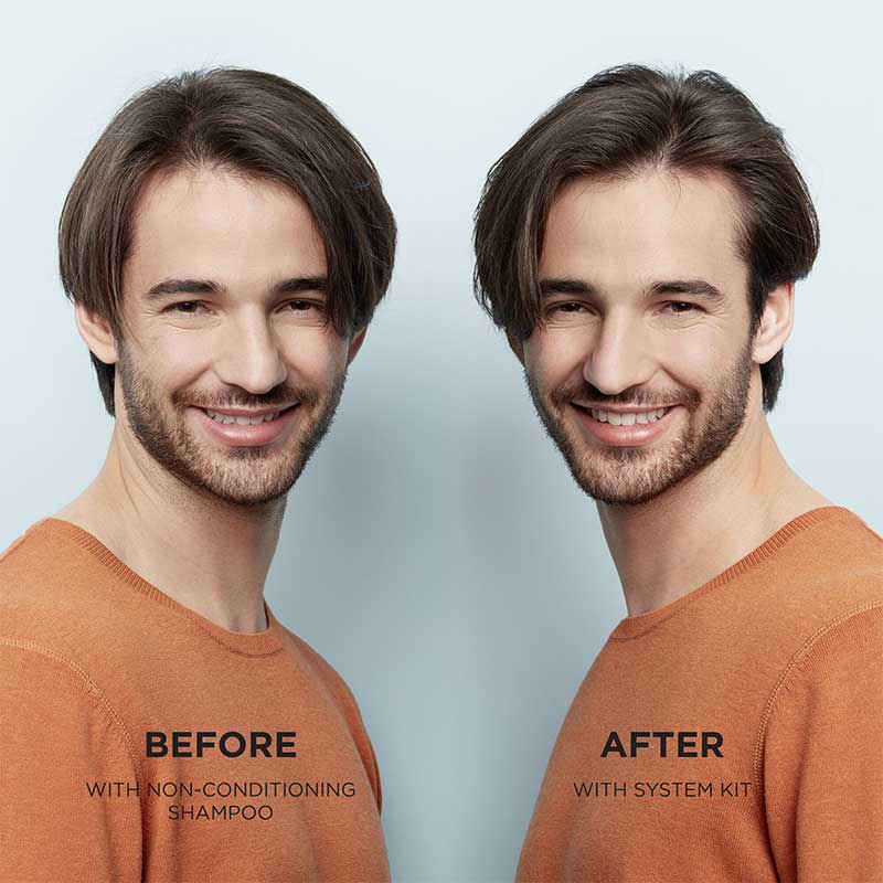 System 1 Scalp Revitaliser Conditioner by Nioxin