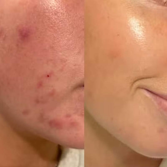 Skin Perfecting 2% BHA Exfoliating Toner Travel Size by Paula's Choice