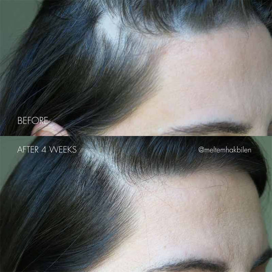 The Hair Serum by SWEED