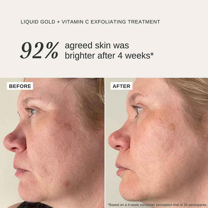 Liquid Gold Exfoliating Treatment 100ml