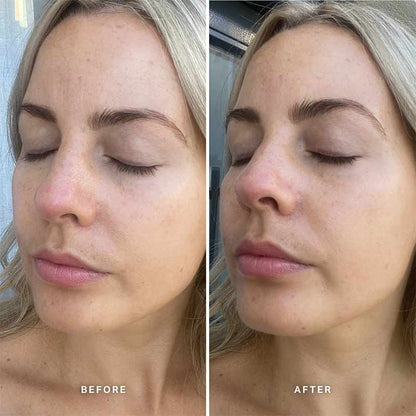 Vitamin E Serum With 1% Ceramide Complex