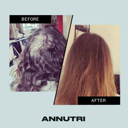 Grow It Hair Growth Supplement by Annutri