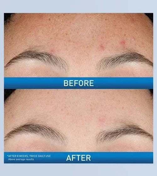 Resurfacing Retinol Serum by CeraVe