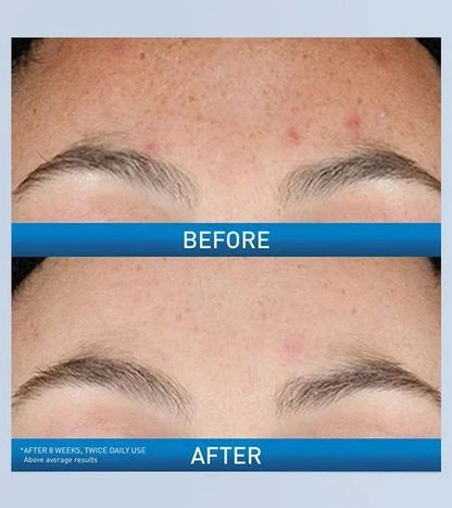 Resurfacing Retinol Serum by CeraVe