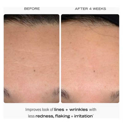 0.3% Retinol Complex Serum With Peptides by First Aid Beauty