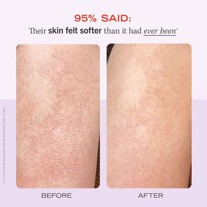 KP Bump Eraser Body Scrub Fresh Strawberry by First Aid Beauty