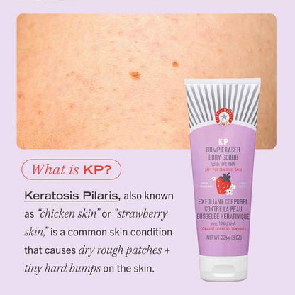 KP Bump Eraser Body Scrub Fresh Strawberry by First Aid Beauty