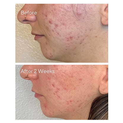 Daily Clarifying Peel