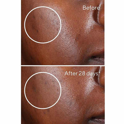 Environmental Shield Rapid Dark Spot Correcting Serum