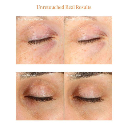 Vita-C Eyes Dark Circle Corrector by Murad