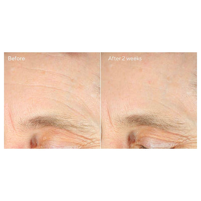 Intense Recovery Cream by Murad