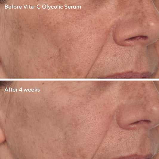 Radiant Skin Discovery Kit