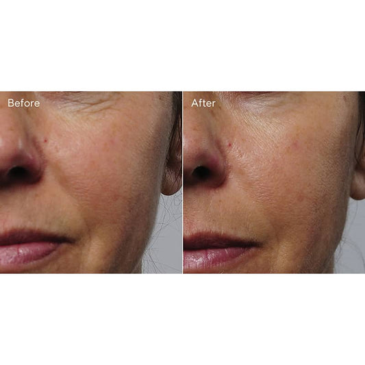 Rapid Collagen Infusion by Murad