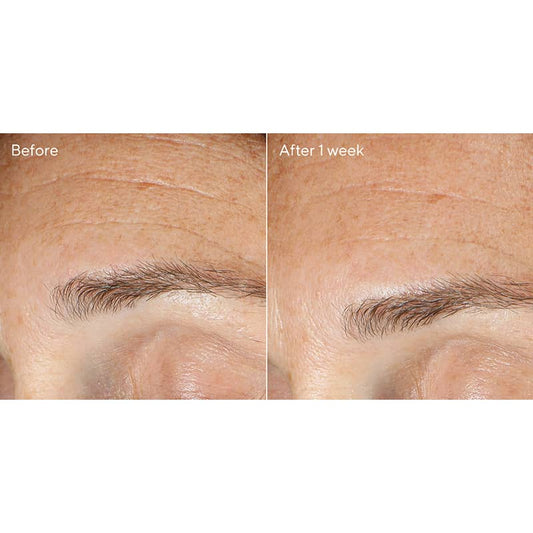 Resurgence Replenishing Multi-Acid Peel 50ml