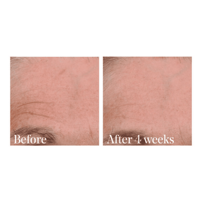 Retinal ReSculpt Overnight Treatment by Murad