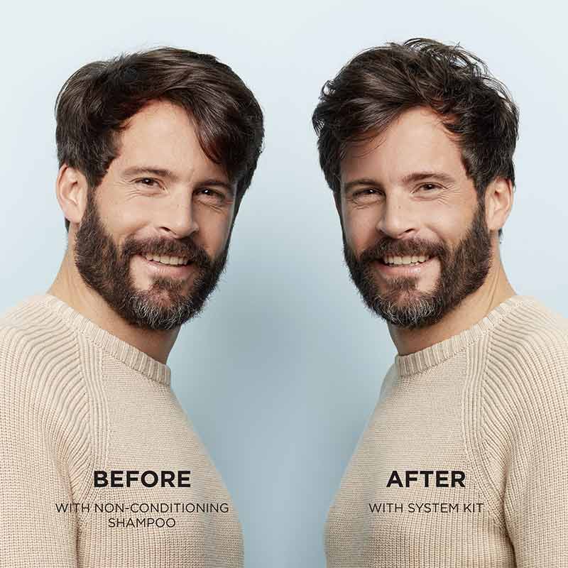 System 1 Three Part Loyalty Kit For Light Thinning by Nioxin