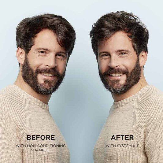 System 1 Three Part Loyalty Kit For Light Thinning by Nioxin