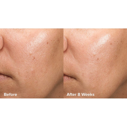 Skin Perfecting 6% Mandelic Acid + 2% Lactic Acid Liquid Exfoliant Travel Size by Paula's Choice