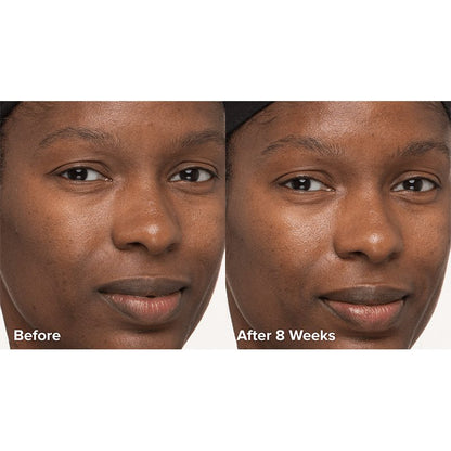 Skin Perfecting 6% Mandelic Acid + 2% Lactic Acid Liquid Exfoliant Travel Size by Paula's Choice