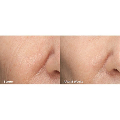 Skin Perfecting 6% Mandelic Acid + 2% Lactic Acid Liquid Exfoliant Travel Size by Paula's Choice
