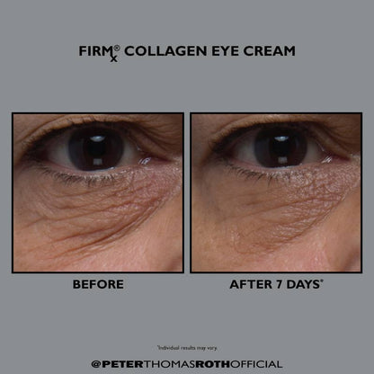 Firmx Collagen Eye Cream by Peter Thomas Roth