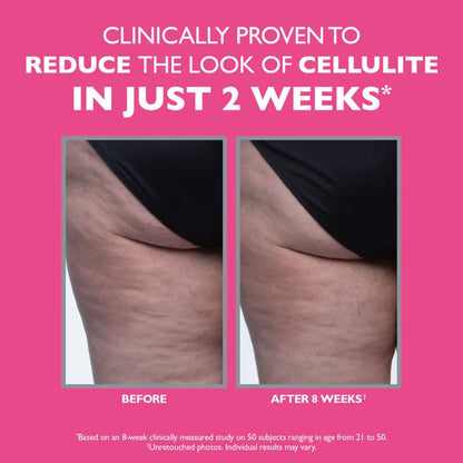 FIRMx Tight & Toned Cellulite Treatment by Peter Thomas Roth