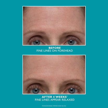 Peptide Skinjection Amplified Wrinkle-Fix Serum by Peter Thomas Roth