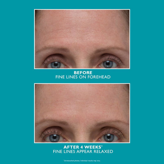 Peptide Skinjection Amplified Wrinkle-Fix Serum by Peter Thomas Roth