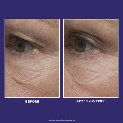 Ultimate Solution 5 Multitasking Eye Cream 15ml