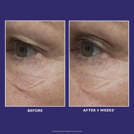 Ultimate Solution 5 Multitasking Eye Cream 15ml
