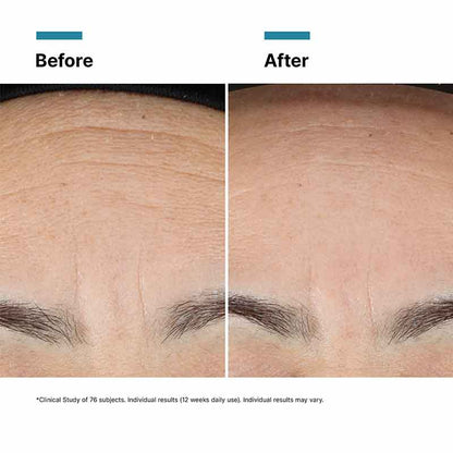 Advanced RGN-6 Aesthetic Recovery Cream by SkinCeuticals