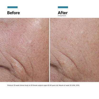 C E Ferulic 15% L-Ascorbic Acid