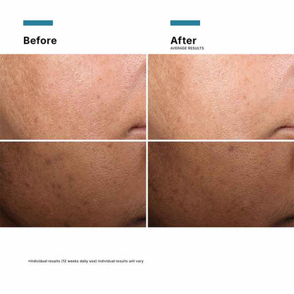 Discoloration Defense Serum 30ml