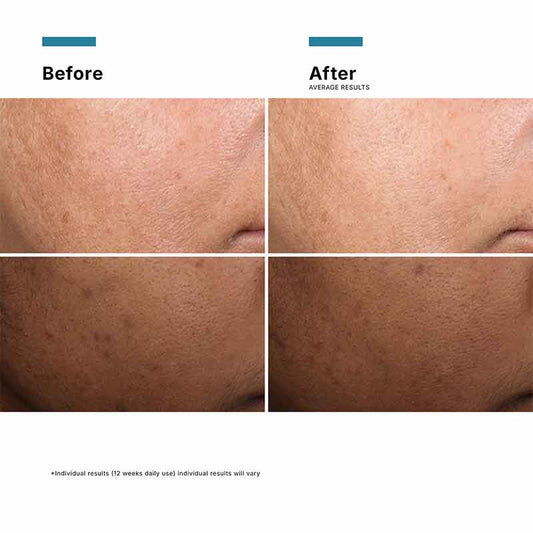 Discoloration Defense Serum 30ml