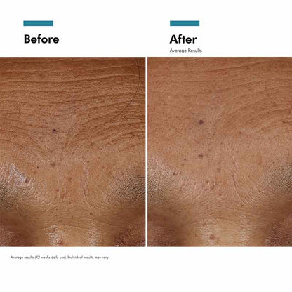 HA Intensifier Multi-Glycan Hyaluronic Acid Serum by SkinCeuticals