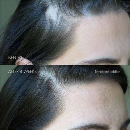 The Hair Serum by SWEED