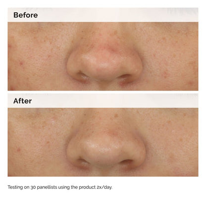 Balancing & Clarifying Serum by The Ordinary