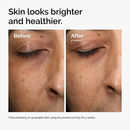 Multi-Antioxidant Radiance Serum by The Ordinary
